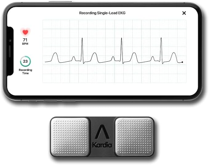 KardiaMobile 1-Lead Personal EKG Monitor – Record at Home – Detects AFib & Irregular Arrhythmias – Easy Results in 30 Seconds – Works w/Most Smartphones-FlexoryFit