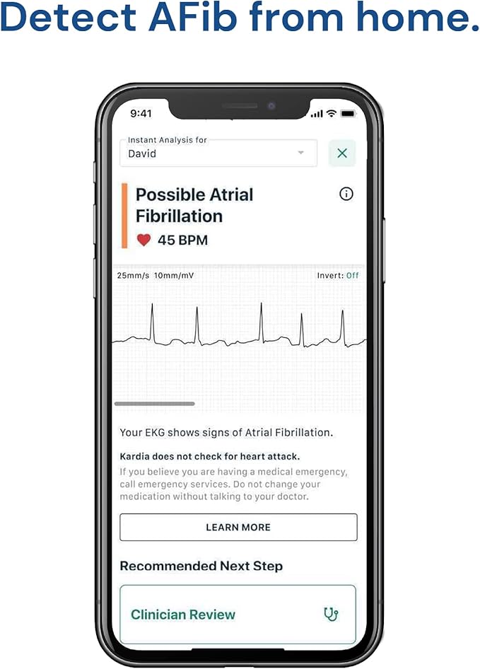 KardiaMobile 1-Lead Personal EKG Monitor – Record at Home – Detects AFib & Irregular Arrhythmias – Easy Results in 30 Seconds – Works w/Most Smartphones-FlexoryFit