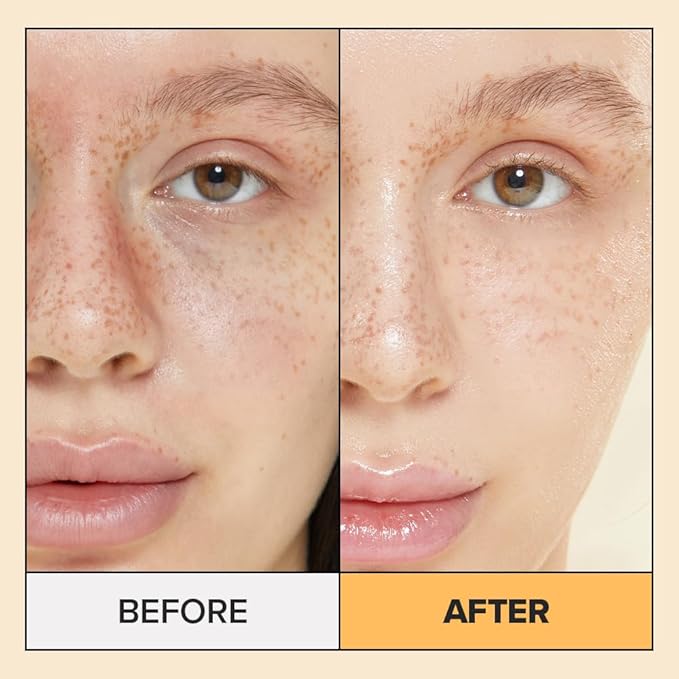 I DEW CARE Real Herb Calendula Sheet Face Mask - Hot As Sheet | Korean Face Masks Skincare, Moisturizing and Calming for Dry Skin with Calendula Flower Extract, 2% Niacinamide, 10EA-FlexoryFit