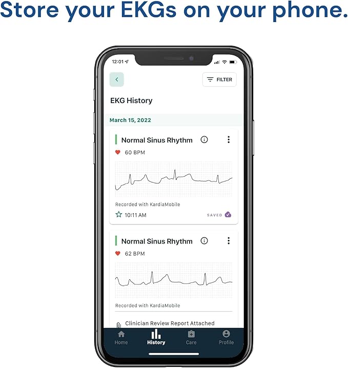 KardiaMobile 1-Lead Personal EKG Monitor – Record at Home – Detects AFib & Irregular Arrhythmias – Easy Results in 30 Seconds – Works w/Most Smartphones-FlexoryFit