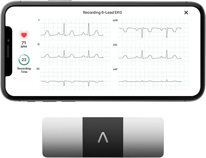 KardiaMobile 6-Lead Personal EKG Monitor – Six Views of The Heart – Detects AFib and Irregular Arrhythmias – Instant Results in 30 Seconds – Works with Most Smartphones-FlexoryFit