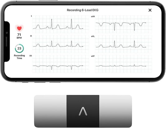 KardiaMobile 6-Lead Personal EKG Monitor – Six Views of The Heart – Detects AFib and Irregular Arrhythmias – Instant Results in 30 Seconds – Works with Most Smartphones-FlexoryFit