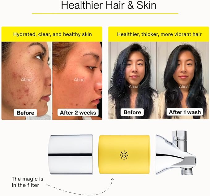 Afina Shower Filter - Shower Head Filter for Hard Water | High Pressure Shower Water Filter - Improves Skin & Hair by Removing Chlorine & Heavy Metals, Transform Your Shower Head with Filters (Black)