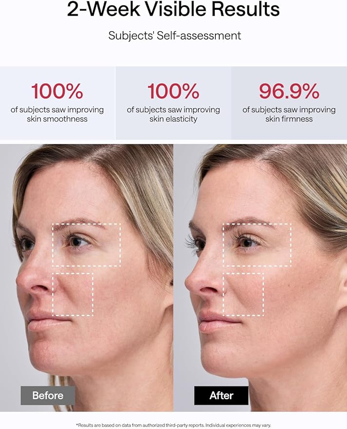 JMOON NouvelleSkin Facial Toning Device, FDA-Cleared Microcurrent Facial Device and Red Light Therapy for Face, 4 Modes & 5 Intensity Levels for Personalized Face Lift & Smoothing. M30U PR-FlexoryFit