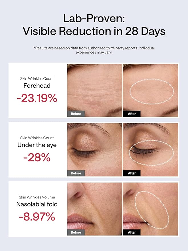 JMOON NouvelleSkin Facial Toning Device, FDA-Cleared Microcurrent Facial Device and Red Light Therapy for Face, 4 Modes & 5 Intensity Levels for Personalized Face Lift & Smoothing. M30U PR-FlexoryFit