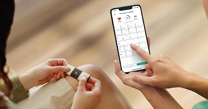 KardiaMobile 6-Lead Personal EKG Monitor – Six Views of The Heart – Detects AFib and Irregular Arrhythmias – Instant Results in 30 Seconds – Works with Most Smartphones-FlexoryFit